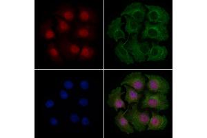 ABIN6262793 and ABIN6279426 staining HepG2 cells by IF/ICC.