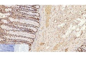 Immunohistochemistry of paraffin-embedded Human colon tissue using CD2 Monoclonal Antibody at dilution of 1:200.