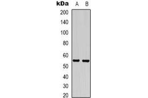 Western blot analysis of GABRG2 expression in mouse brain (A), rat brain (B) whole cell lysates. (GABRG2 anticorps)