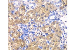 Immunohistochemistry of paraffin-embedded Rat kidney using HPD Polyclonal Antibody at dilution of 1:100 (40x lens). (HPD anticorps)