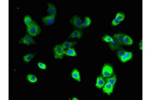 anti-ATPase, H+ Transporting, Lysosomal V0 Subunit A2 (ATP6V0A2) (AA 476-549), (Isoform 2) antibody