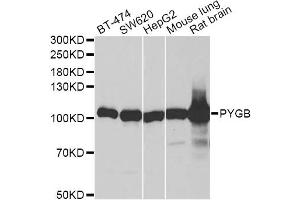 Western blot analysis of extracts of various cell lines, using PYGB antibody (ABIN6293330) at 1:1000 dilution. (PYGB anticorps)
