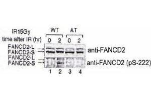 Indicated lymphoblasts (PD7, WT : GM1526, AT) were irradiated with 15 Gy (2), and immunoblotted with anti-FANCD2 and FANCD2 (phospho S222) polyclonal antibody . (FANCD2 anticorps  (pSer222))