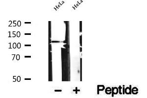 Western blot analysis of extracts of HeLa cells, using DAAM1 antibody. (DAAM1 anticorps  (Internal Region))
