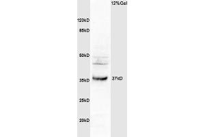 L1 human colon carcinoma lysates probed with Anti OSTM1 Polyclonal Antibody, Unconjugated (ABIN1387308) at 1:200 overnight at 4 °C.