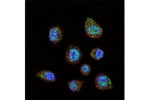 Confocal immunofluorescent analysis of HIF-1 alpha antibody with MDA-MB231 cells followed by Alexa Fluor 488-conjugated goat anti-rabbit lgG (green).