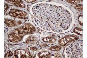 Image no. 10 for anti-SERPINE1 mRNA Binding Protein 1 (SERBP1) (AA 1-262) antibody (ABIN1490675)