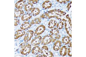 Immunohistochemistry of paraffin-embedded mouse kidney using Cytochrome P450 4A (CYP4) (CYP4) Rabbit mAb (ABIN7266658) at dilution of 1:100 (40x lens).