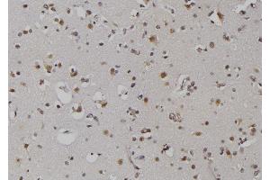 anti-Zinc Ribbon Domain Containing 1 (ZNRD1) (Internal Region) antibody