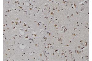 ABIN6279367 at 1/100 staining Human brain tissue by IHC-P. (ZNRD1 anticorps  (Internal Region))