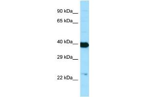 Western Blotting (WB) image for anti-N-Acetylneuraminic Acid Synthase (NANS) (C-Term) antibody (ABIN2790121)