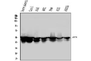 Western blot analysis of Cytokeratin 8 using anti-Cytokeratin 8 antibody (ABIN6719478). (KRT8 anticorps  (AA 107-325))