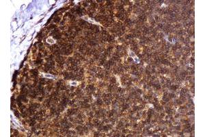 Image no. 3 for anti-B and T Lymphocyte Associated (BTLA) antibody (ABIN1496983) (BTLA anticorps)