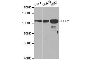 Western blot analysis of extracts of various cell lines, using EEF2 antibody. (EEF2 anticorps  (AA 1-290))