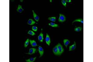 Immunofluorescence staining of A549 cells with ABIN7148830 at 1:66, counter-stained with DAPI. (GARP anticorps  (AA 131-253))