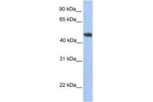 Western Blotting (WB) image for anti-Asparagine-Linked Glycosylation 2, alpha-1,3-Mannosyltransferase Homolog (ALG2) antibody (ABIN2463245) (ALG2 anticorps)