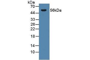 Detection of CYP21A2 in Rat Adrenal Gland Tissue using Polyclonal Antibody to Cytochrome P450 Family 21 Subfamily A Member 2 (CYP21A2) (CYP21A2 anticorps  (AA 106-389))