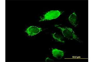 Immunofluorescence of purified MaxPab antibody to KCNIP2 on HeLa cell. (KCNIP2 anticorps  (AA 1-270))