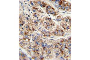 Immunohistochemistry (IHC) image for anti-Enoyl-CoA, Hydratase/3-Hydroxyacyl CoA Dehydrogenase (EHHADH) antibody (ABIN3003844)