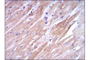 Immunohistochemical analysis of paraffin-embedded cardiac muscle tissues using TNNI2 mouse mAb with DAB staining. (TNNI2 anticorps)