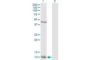 Western Blot analysis of CCL2 expression in transfected 293T cell line by CCL2 monoclonal antibody (M12), clone 4B12. (CCL2 anticorps  (AA 1-99))