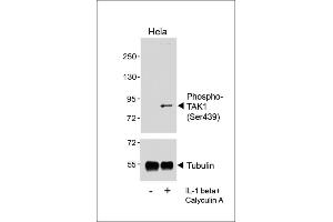Western blot analysis of lysates from Hela cell line, untreated or treated with IL-1beta(20 ng/mL) +Calyculin A(100 nM), using  (upper) or Tubulin (lower).