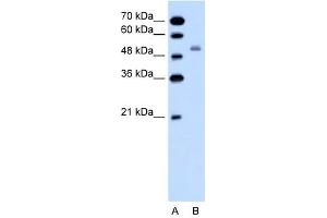 SLC12A1 antibody used at 1 ug/ml to detect target protein. (SLC12A1 anticorps)