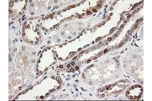 Image no. 3 for anti-LSM1 Homolog, U6 Small Nuclear RNA Associated (LSM1) antibody (ABIN1499210)