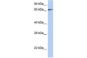 ZNF676 antibody used at 0. (ZNF676 anticorps  (Middle Region))