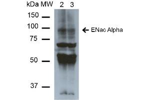 Western Blot analysis of Mouse Whole kidney homogenates showing detection of ~85kDa ENaC alpha protein using Mouse Anti-ENaC alpha Monoclonal Antibody, Clone 2G4 . (SCNN1A anticorps  (AA 46-68) (Atto 390))