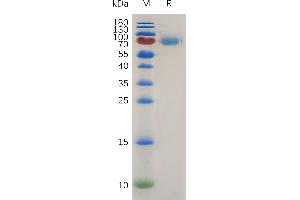 Mouse IL2RA Protein, hFc Tag on SDS-PAGE under reducing condition.