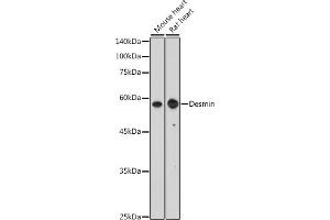 Western blot analysis of extracts of C2C12 cells, using Desmin antibody (ABIN3021114, ABIN3021115, ABIN3021116 and ABIN6213957) at 1:400 dilution.