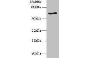Western blot All lanes: ALAS2 antibody at 6 μg/mL + K562 whole cell lysate Secondary Goat polyclonal to rabbit IgG at 1/10000 dilution Predicted band size: 65, 61, 50, 64 kDa Observed band size: 65 kDa (ALAS2 anticorps  (AA 50-587))