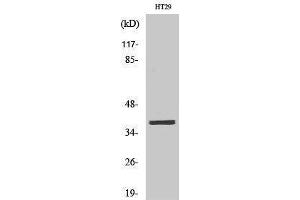 Western Blotting (WB) image for anti-MEF2BNB-MEF2B Readthrough (MEF2BNB-MEF2B) (Internal Region) antibody (ABIN3175960) (MEF2BNB-MEF2B Readthrough (MEF2BNB-MEF2B) (Internal Region) anticorps)