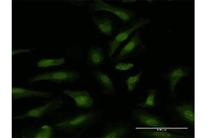 Immunofluorescence of purified MaxPab antibody to DDX6 on HeLa cell. (DDX6 anticorps  (AA 1-472))