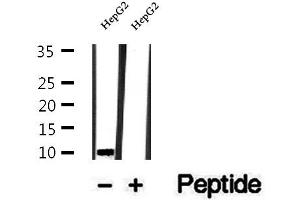 Western blot analysis of extracts of HepG2 cells, using UQCRQ antibody. (UQCRQ anticorps  (Internal Region))