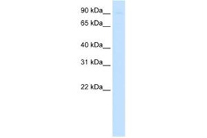 WB Suggested Anti-SIRT1 Antibody   Titration: 0. (SIRT1 anticorps  (N-Term))