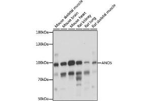 Western blot analysis of extracts of various cell lines, using  antibody (ABIN7265626) at 1:1000 dilution.