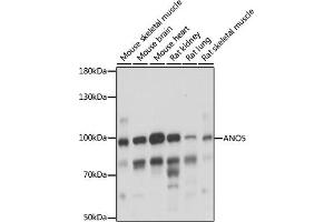 Western blot analysis of extracts of various cell lines, using  antibody (ABIN7265626) at 1:1000 dilution. (Anoctamin 5 anticorps  (AA 1-300))