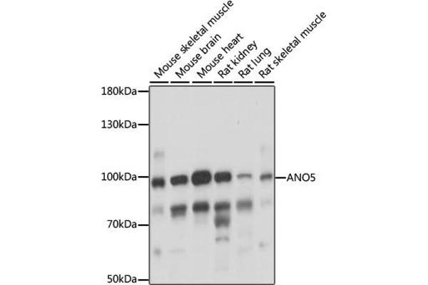 Anoctamin 5 anticorps  (AA 1-300)