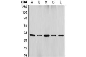 Western blot analysis of DFF45 expression in HeLa (A), U937 (B), WR19L (C), HEK293T (D), Jurkat (E) whole cell lysates. (DFFA anticorps  (Center))