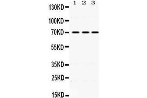 Western Blotting (WB) image for anti-Kelch-Like ECH-Associated Protein 1 (KEAP1) (AA 25-205) antibody (ABIN3043275)