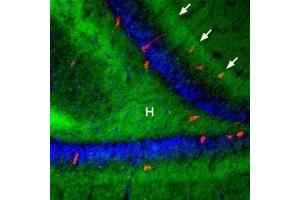 Expression of β3-Adrenoceptor in rat hippocampus - Immunohistochemical staining of rat hippocampal dentate gyrus using Anti-β3-Adrenergic Receptor (extracellular) Antibody (ABIN7042907, ABIN7043912 and ABIN7043913), (1:100), (green).
