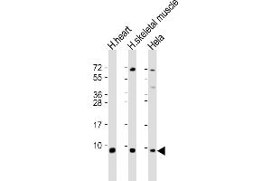 All lanes : Anti-ATP5E Antibody (C-Term) at 1:2000 dilution Lane 1: human heart lysate Lane 2: human skeletal muscle lysate Lane 3: Hela whole cell lysate Lysates/proteins at 20 μg per lane.