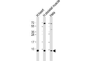 All lanes : Anti-ATP5E Antibody (C-Term) at 1:2000 dilution Lane 1: human heart lysate Lane 2: human skeletal muscle lysate Lane 3: Hela whole cell lysate Lysates/proteins at 20 μg per lane. (ATP5E anticorps  (AA 21-51))