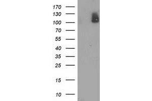 Western Blotting (WB) image for anti-phosphodiesterase 2A, CGMP-Stimulated (PDE2A) antibody (ABIN1500076) (PDE2A anticorps)