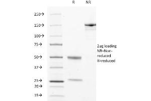 SDS-PAGE Analysis Purified CD63 Mouse Monoclonal Antibody (529). (CD63 anticorps)