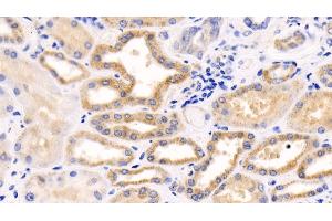 Detection of MCL1 in Human Kidney Tissue using Polyclonal Antibody to Induced Myeloid Leukemia Cell Differentiation Protein Mcl-1 (MCL1)