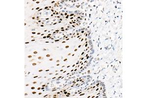 anti-Proliferating Cell Nuclear Antigen (PCNA) antibody