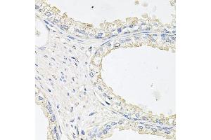 Immunohistochemistry of paraffin-embedded human prostate using EPOR antibody. (EPOR anticorps)